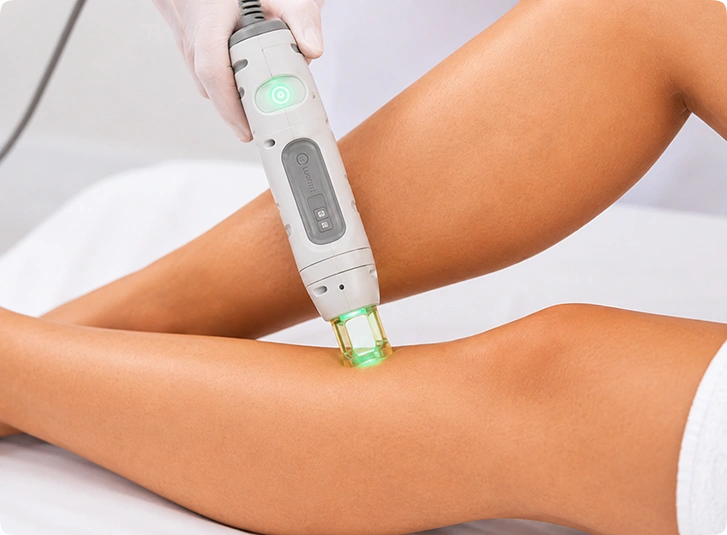 Laser Hair Reduction Treatment in Mysore